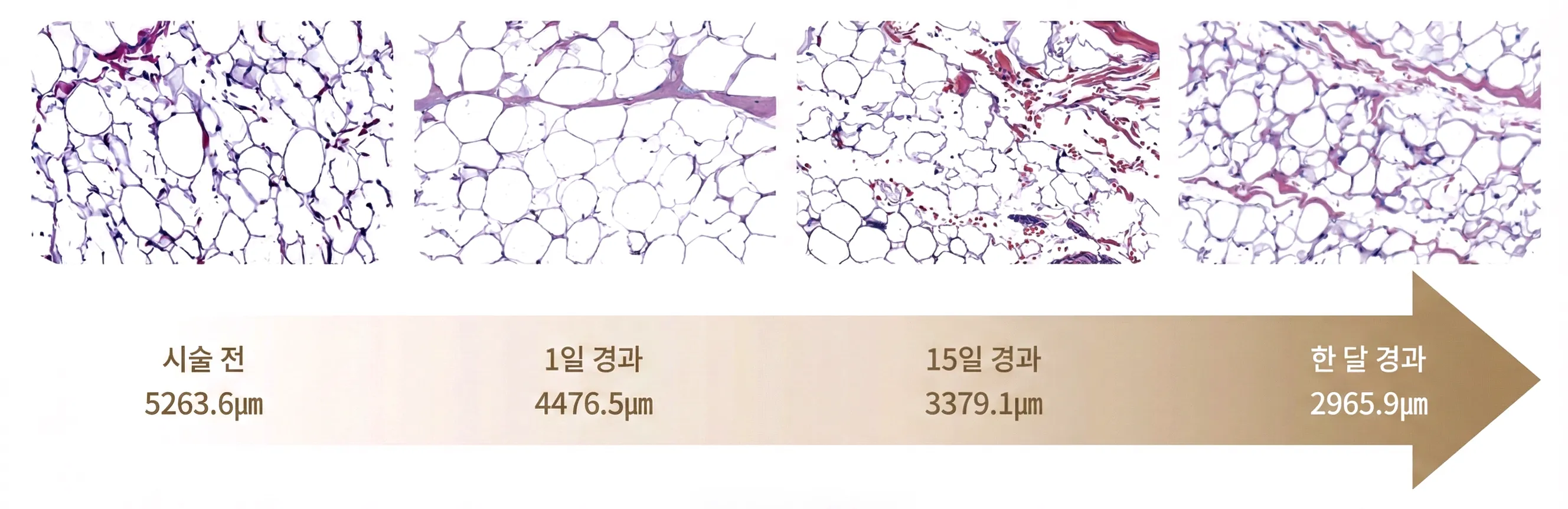 노블쉐이프